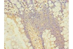 Immunohistochemistry of paraffin-embedded human small intestine tissue using ABIN7143534 at dilution of 1:100 (SLC25A4 Antikörper  (AA 40-74))