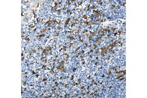 IHC analysis of CD38 using anti-CD38 antibody (ABIN7602815). (CD38 Antikörper  (C-Term))