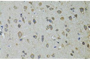 Immunohistochemistry of paraffin-embedded Rat brain using UGDH Polyclonal Antibody at dilution of 1:100 (40x lens). (UGDH Antikörper)