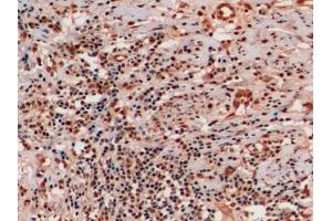 Immunohistochemistry (IHC) image for anti-Ubiquitin (Ub) (AA 1-229) antibody (ABIN7428593)
