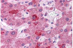 Immunohistochemistry (Formalin-fixed Paraffin-embedded Sections) (IHC (fp)) image for anti-Hepatocyte Growth Factor (Hepapoietin A, Scatter Factor) (HGF) (AA 216-265) antibody (ABIN604744)