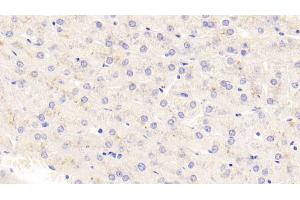 Detection of TSLP in Human Liver Tissue using Polyclonal Antibody to Thymic Stromal Lymphopoietin (TSLP) (Thymic Stromal Lymphopoietin Antikörper  (AA 29-159))