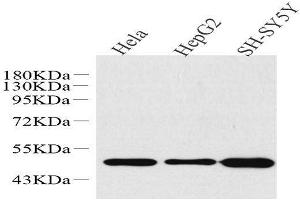 Western Blot analysis of various samples using GLUT-3 Polyclonal Antibody at dilution of 1:1000. (SLC2A3 Antikörper)