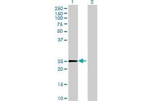 Western Blot analysis of DHRS4L2 expression in transfected 293T cell line by DHRS4L2 MaxPab polyclonal antibody. (DHRS4L2 Antikörper  (AA 1-230))