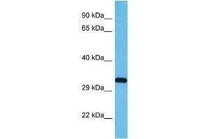 Host:  Mouse  Target Name:  USF1  Sample Tissue:  Mouse Testis  Antibody Dilution:  1ug/ml (USF1 Antikörper  (Middle Region))