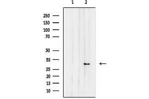 anti-Cleavage and Polyadenylation Specific Factor 4, 30kDa (CPSF4) (C-Term) antibody