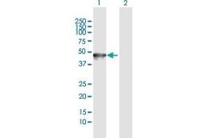 Western Blot analysis of KRT35 expression in transfected 293T cell line by KRT35 MaxPab polyclonal antibody. (Keratin 35 Antikörper  (AA 1-455))
