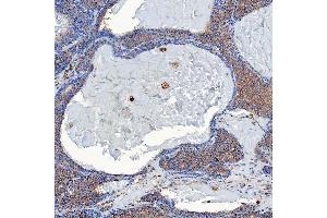 IHC analysis of SETD3 using anti-SETD3 antibody (ABIN7600293).