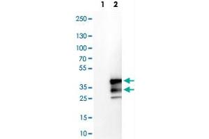 Western Blot analysis of Lane 1: negative control (vector only transfected HEK293T cell lysate) and Lane 2: over-expression lysate (co-expressed with a C-terminal myc-DDK tag in mammalian HEK293T cells) with VPS24 polyclonal antibody . (CHMP3 Antikörper)