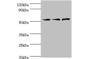 Western blot All lanes: ACVR1C antibody at 4 μg/mL Lane 1: Mouse brain tissue Lane 2: HepG2 whole cell lysate Lane 3: Hela whole cell lysate Secondary Goat polyclonal to rabbit IgG at 1/10000 dilution Predicted band size: 55, 38, 47, 50 kDa Observed band size: 55 kDa (ACVR1C/ALK7 Antikörper  (AA 22-113))