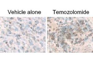 LC3B staining of MAP1LC3B in treated U87-MG cultured & subcutaneous tumors using MAP1LC3B polyclonal antibody . (LC3B Antikörper  (AA 1-50))