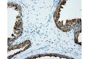 Immunohistochemical staining of paraffin-embedded liver tissue using anti-NME4 mouse monoclonal antibody. (NME4 Antikörper)