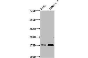 Western Blot Positive WB detected in: K562 whole cell lysate, RAW264. (VAMP4 Antikörper  (AA 1-115))