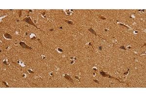Immunohistochemistry (Paraffin-embedded Sections) (IHC (p)) image for anti-NADH Dehydrogenase (Ubiquinone) Fe-S Protein 5, 15kDa (NADH-Coenzyme Q Reductase) (NDUFS5) antibody (ABIN7237496)