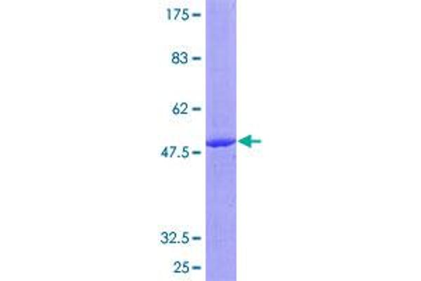 IL17C Protein (AA 1-197) (GST tag)