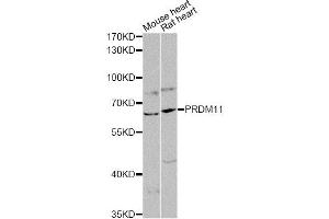 Western blot analysis of extracts of various cell lines, using PRDM11 antibody (ABIN6290764) at 1:1000 dilution. (PRDM11 Antikörper)