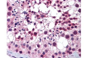 Immunohistochemistry (IHC) image for anti-Polo-Like Kinase 1 (PLK1) (C-Term) antibody (ABIN2782496) (PLK1 Antikörper  (C-Term))