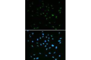 Immunofluorescence analysis of A549 cells using MSH6 antibody (ABIN5971626). (MSH6 Antikörper)