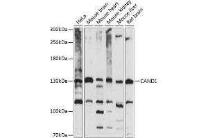 Western blot analysis of extracts of various cell lines, using C antibody (ABIN7266546) at 1:1000 dilution. (CAND1 Antikörper  (AA 750-980))