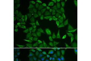 Immunofluorescence analysis of HeLa cells using CLPS Polyclonal Antibody (CLPS Antikörper)
