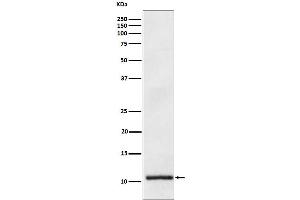 Western blot analysis of Apolipoprotein A II expression in Human plasma lysate.