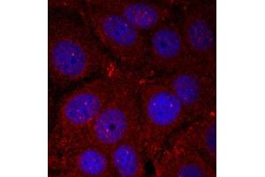 Immunofluorescence staining of methanol-fixed Hela cells using Phospho-SNCA-Y136 antibody. (SNCA Antikörper  (pTyr136))