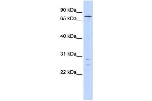 Western Blotting (WB) image for anti-Kelch-Like 4 (KLHL4) antibody (ABIN2458392) (Kelch-Like 4 Antikörper)
