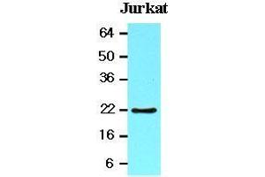 The lysates of Jurkat (20 ug) were resolved by SDS-PAGE, transferred to nitrocellulose membrane and probed with anti-human BID (1:1000). (BID Antikörper  (AA 1-195))