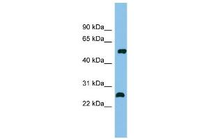 WB Suggested Anti-MEF2D Antibody Titration: 0. (MEF2D Antikörper  (Middle Region))