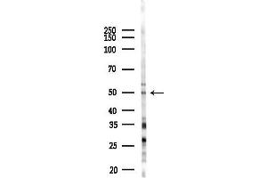 anti-DNA Repair Protein RAD51 Homolog 3 (RAD51C) (Internal Region) antibody