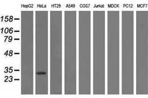 Western blot analysis of extracts (35 µg) from 9 different cell lines by using anti-GSTT2 monoclonal antibody. (GSTT2 Antikörper)
