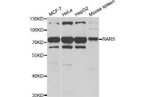 Western Blotting (WB) image for anti-Arginyl-tRNA Synthetase (RARS) antibody (ABIN1980323) (RARS Antikörper)