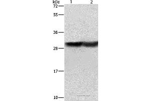 Western blot analysis of Human fetal brain and mouse kidney tissue, using CALB1 Polyclonal Antibody at dilution of 1:600 (CALB1 Antikörper)