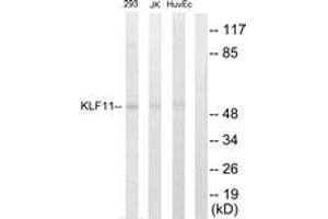 Western blot analysis of extracts from 293/Jurkat/HuvEc cells, using KLF11 Antibody. (KLF11 Antikörper  (AA 1-50))