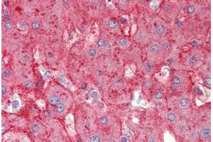 Human Liver (formalin-fixed, paraffin-embedded) stained with APOE antibody ABIN337117 at 2. (APOE Antikörper  (AA 305-317))