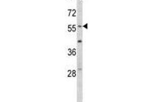 Western Blotting (WB) image for anti-Early Growth Response 1 (EGR1) (AA 9-37) antibody (ABIN3028632)