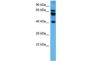 Host:  Mouse  Target Name:  PARD6B  Sample Tissue:  Mouse Brain  Antibody Dilution:  1ug/ml (PARD6B Antikörper  (N-Term))