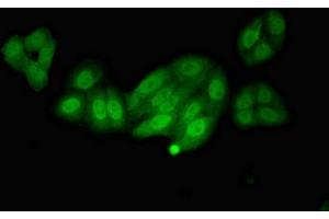 Immunofluorescent analysis of HepG2 cells using ABIN7146747 at dilution of 1:100 and Alexa Fluor 488-congugated AffiniPure Goat Anti-Rabbit IgG(H+L) (NOS1AP Antikörper  (C-Term))