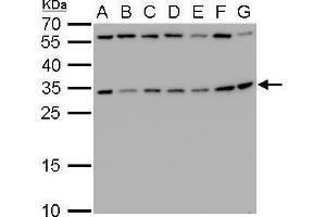 Western Blotting (WB) image for anti-Ribosomal Protein S3A (RPS3A) antibody (ABIN2856016)