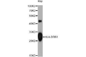 Western blot analysis of extracts of Raji cells, using HLA-DRB3 antibody (ABIN1873032) at 1:1000 dilution.