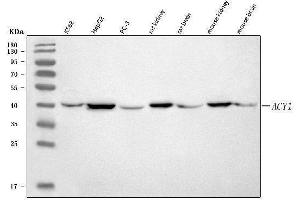 Western blot analysis of ACY-1/ACY1 using anti-ACY-1/ACY1 antibody (ABIN7602484).