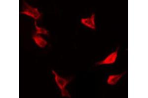ABIN6267416 staining Hela by IF/ICC. (PTPN1 Antikörper  (pSer50))