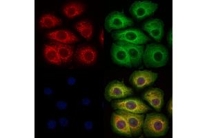 ABIN6265508 and ABIN6273329 staining Hela cells by IF/ICC. (TCTN2 Antikörper  (Internal Region))