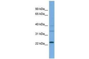 Image no. 1 for anti-Ras-related Protein Ral-A (rala) (AA 71-120) antibody (ABIN6745668) (rala Antikörper  (AA 71-120))