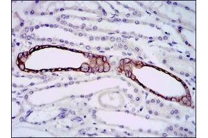 Immunohistochemistry (IHC) image for anti-BPI Fold Containing Family A, Member 2 (BPIFA2) antibody (ABIN969541)