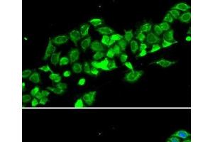 Immunofluorescence analysis of MCF-7 cells using RASSF1 Polyclonal Antibody (RASSF1 Antikörper)