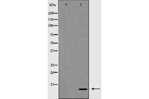 Western blot analysis on 293 cell lysate using Insulin Antibody,The lane on the left is treated with the antigen-specific peptide. (Insulin Antikörper)