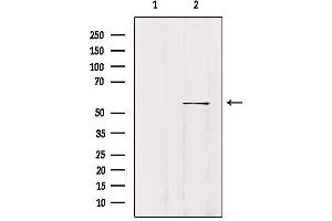 Western blot analysis of extracts from B16F10, using WASF2 Antibody. (WASF2 Antikörper  (Internal Region))