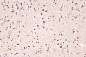 Immunohistochemistry of paraffin-embedded mouse spinal cord using DDX17 Rabbit mAb (ABIN7266688) at dilution of 1:100 (40x lens). (DDX17 Antikörper)