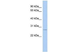 Nurim antibody used at 1 ug/ml to detect target protein.